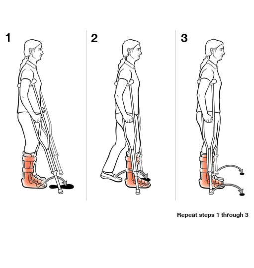 3 steps in using crutches with step to (weight bearing)